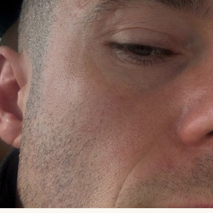 Close-up van de huid tijdens het testen